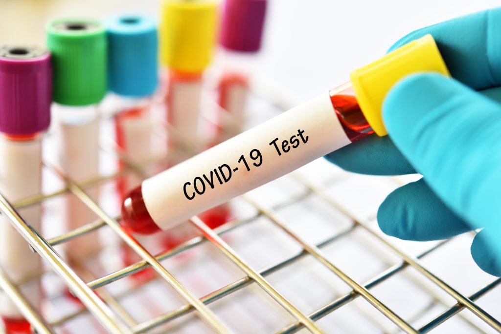 Testes de coronavírus