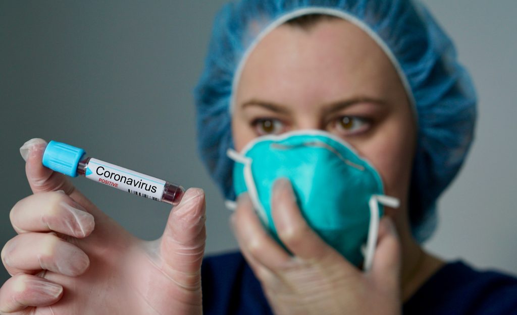 Testes rápidos de coronavírus