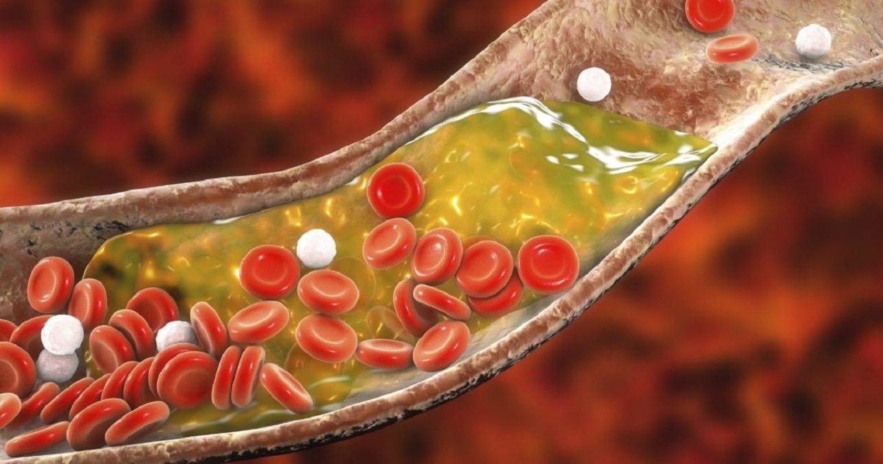 Farmacêutica da Drogaria São Paulo explica sobre os tipos de colesterol