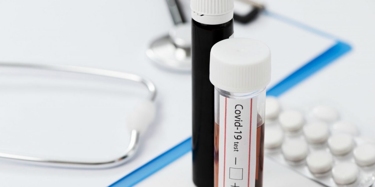 CFF lança curso para farmacêuticos sobre testes de Covid-19